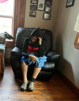 A ‘quiet’ liver disease is on the rise in Hispanic people