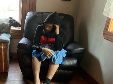 A ‘quiet’ liver disease is on the rise in Hispanic people