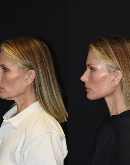 They’re Old, but not Me: Feeling Younger Than Ever