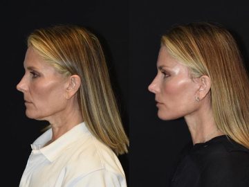 They’re Old, but not Me: Feeling Younger Than Ever