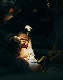 The rate of cesarean births in the U.S. has gone up, again