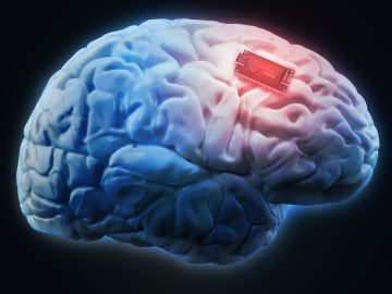 Fully bilingual? Get a brain implant