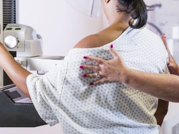 Breast cancer rising among younger women, report finds