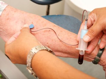 FDA Approves First Blood Test to Diagnose Alzheimer’s in Adults with Cognitive Decline