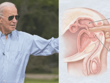 Biden’s Prostate Cancer Diagnosis Highlights Surge in California Cases