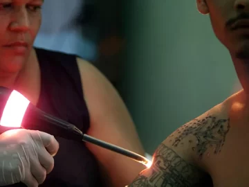 Fearing deportation, thousands seek to erase their tattoos