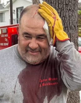 Violence goes viral; a homeless man violently attacks a Latino gardener