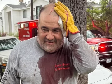 Violence goes viral; a homeless man violently attacks a Latino gardener