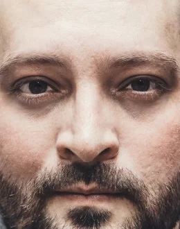 How to Get Rid of Dark Circles and Eye Bags