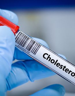 High Cholesterol Foods: What Science Says Raises — and Lowers — Your Risk