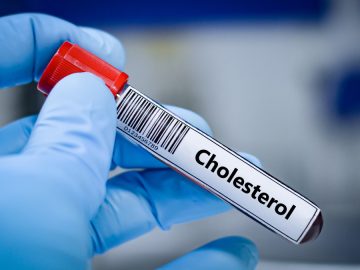 High Cholesterol Foods: What Science Says Raises — and Lowers — Your Risk