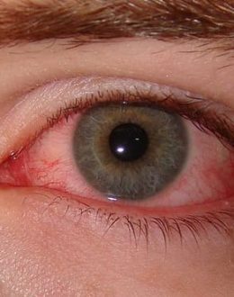 Why Winter Is Drying Out Your Eyes — and How to Find Real Relief