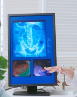 Colon Cancer Is Rising in Younger Adults — and Latino Communities Are Being Left Behind on Screening