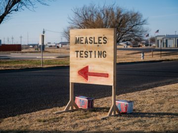 Measles Cases Climb in California Amid Warnings of Outbreak at ICE Detention Center