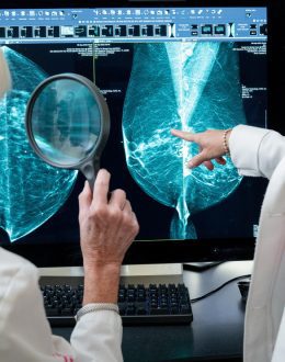 Sharp 29% Rise in Breast Cancer Among Young Women Over Three Decades