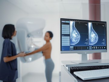 AI Mammograms May Detect Heart Disease Risk in Women