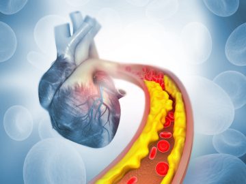 New Heart Guidelines Could Save Lives: How Latinos Can Lower LDL Early