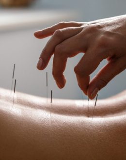 Does Acupuncture Hurt? What Doctors and Research Actually Say
