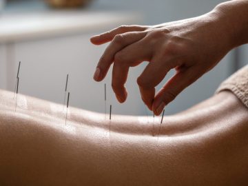 Does Acupuncture Hurt? What Doctors and Research Actually Say