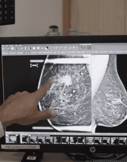 New Breast Cancer Drugs Are Changing Treatment. Here’s When They May Work Better Than Chemotherapy