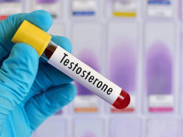 Testosterone Is Having a Moment. What Latino Men Should Know Before Getting Tested or Starting TRT