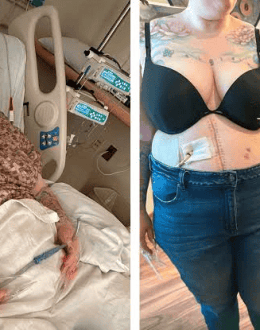 AMERICAN’S TIJUANA NIGHTMARE: Julia Carpenter Stapled Shut in Botched Surgery, Now Judge Sides With Her