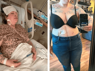 AMERICAN’S TIJUANA NIGHTMARE: Julia Carpenter Stapled Shut in Botched Surgery, Now Judge Sides With Her